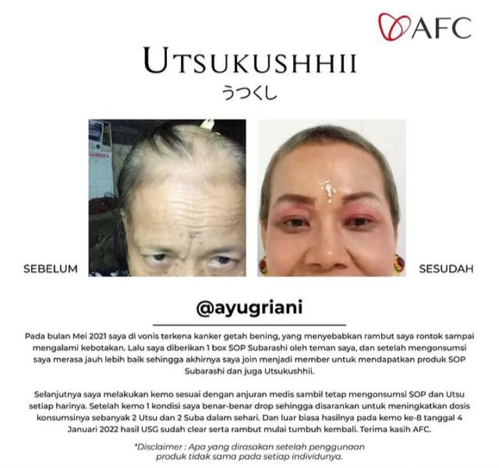 SOP Subarashi